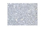 Effet granit gris en zoom
